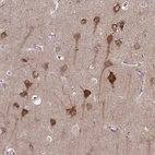 Immunohistochemical staining of human cerebral cortex shows strong cytoplasmic positivity in neurons.