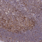 Immunohistochemical staining of human tonsil shows strong cytoplasmic positivity in germinal center cells.