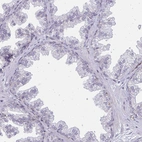 Immunohistochemical staining of human prostate shows no positivity in glandular cells as expected.