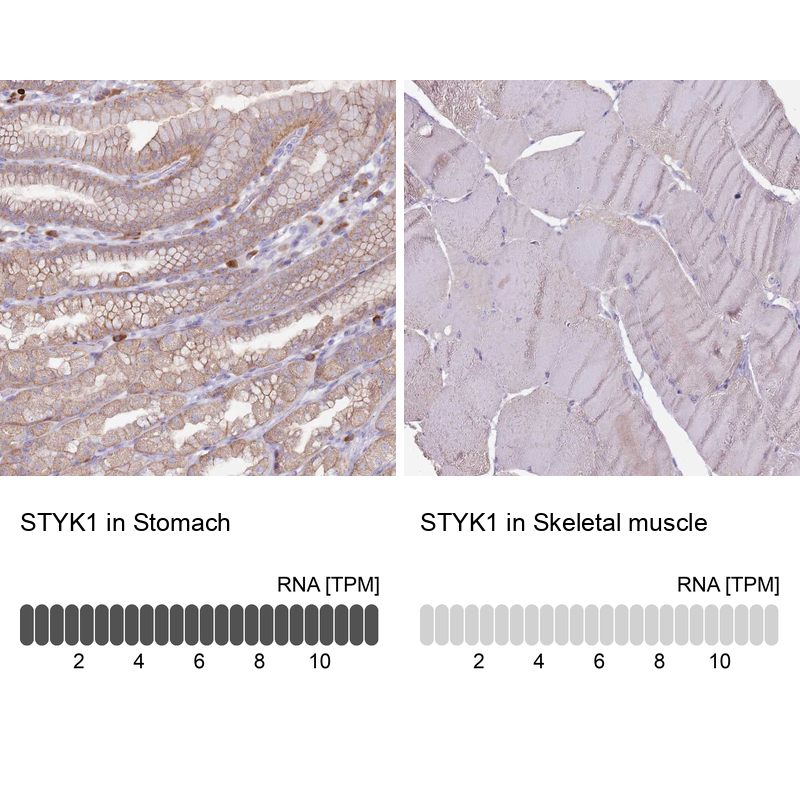 Anti-STYK1 Antibody