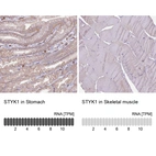 Anti-STYK1 Antibody