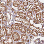 Immunohistochemical staining of human kidney shows strong cytoplasmic positivity in cells in tubules.