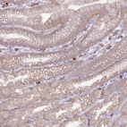 Immunohistochemical staining of human stomach shows strong membranous positivity in glandular cells.