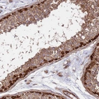 Immunohistochemical staining of human testis shows moderate to strong cytoplasmic positivity in cells in seminiferous ducts.