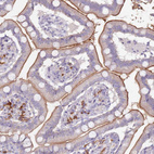 Immunohistochemical staining of human small intestine shows strong membranous positivity in glandular cells.