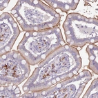 Immunohistochemical staining of human small intestine shows strong membranous positivity in glandular cells.