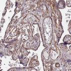 Immunohistochemical staining of human placenta shows moderate cytoplasmic positivity in trophoblastic cells.
