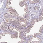 Immunohistochemical staining of human prostate shows moderate membranous positivity in glandular cells.