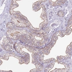 Immunohistochemical staining of human prostate shows moderate membranous positivity in glandular cells.