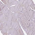 Immunohistochemical staining of human skeletal muscle shows no membranous positivity in myocytes as expected.