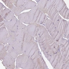 Immunohistochemical staining of human skeletal muscle shows no membranous positivity in myocytes as expected.