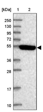 Lane 1: Marker [kDa] 250, 130, 95, 72, 55, 36, 28, 17, 10_br/_Lane 2: Human cell line RT-4