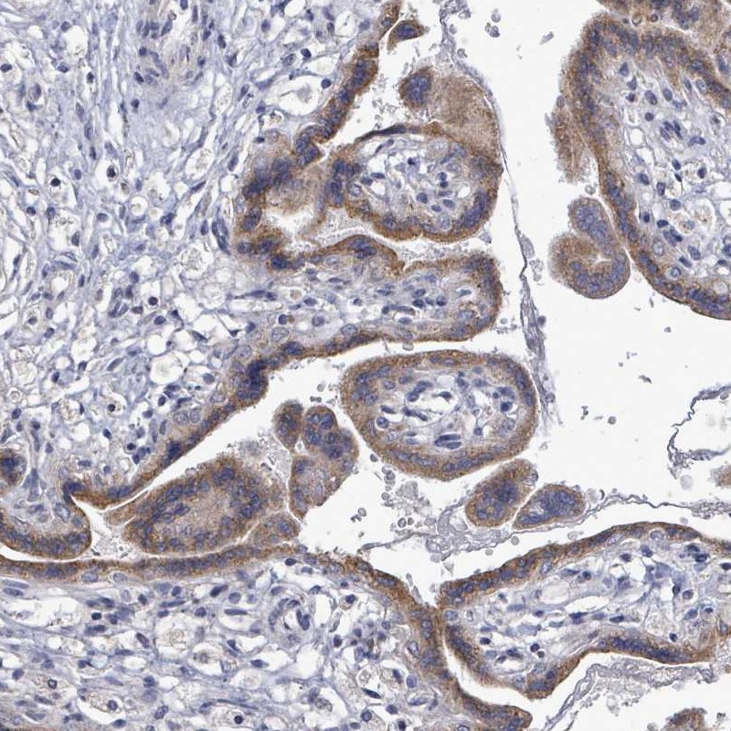 Anti-SLC13A4 Antibody