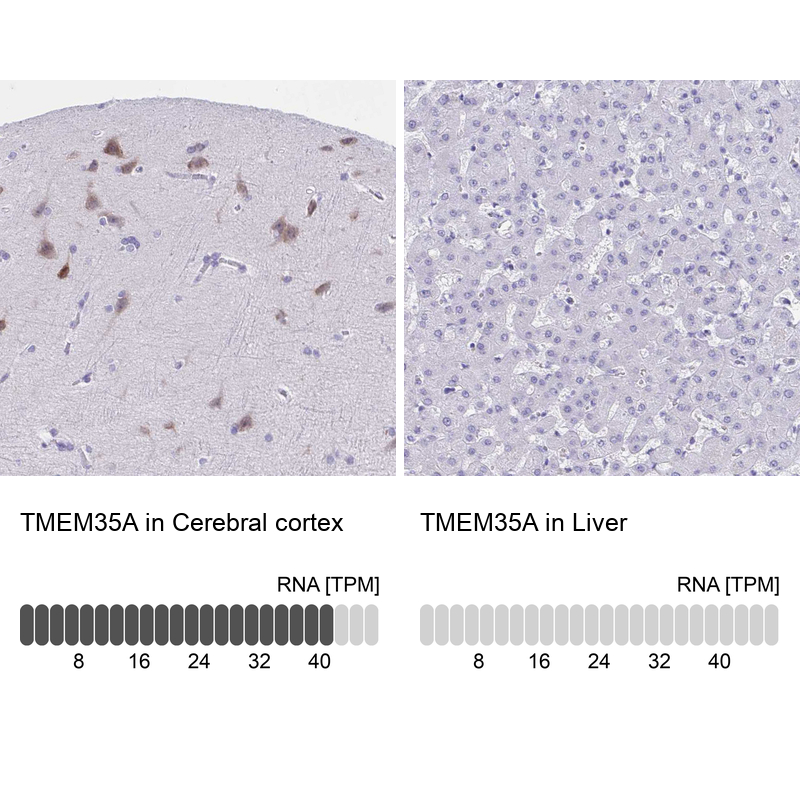 Anti-TMEM35A Antibody