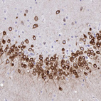 Immunohistochemical staining of human hippocampus shows moderate to strong cytoplasmic positivity in neuronal cells.
