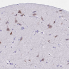 Immunohistochemical staining of human cerebral cortex shows moderate cytoplasmic positivity in neuronal cells.