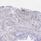 Immunohistochemical staining of human smooth muscle shows moderate cytoplasmic positivity in myocytes.