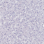Anti-TMEM35A Antibody