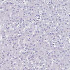 Immunohistochemical staining of human liver shows no cytoplasmic positivity in hepatocytes as expected.