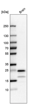 Western blot analysis in human brain tissue.