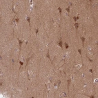 Anti-GUK1 Antibody