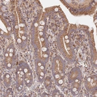 Immunohistochemical staining of humanduodenum shows moderate granular cytoplasmic positivity in glandular cells.