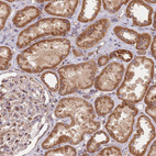 Immunohistochemical staining of human kidney shows moderate granular cytoplasmic positivity in cells in tubules.