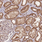 Immunohistochemical staining of human kidney shows moderate granular cytoplasmic positivity in cells in tubules.