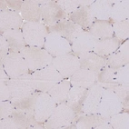 Immunohistochemical staining of human skeletal muscle shows very weak positivity in myocytes as expected.