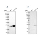 Western blot analysis using Anti-GUK1 antibody HPA048587 (A) shows similar pattern to independent antibody HPA028118 (B).