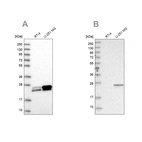 Western blot analysis using Anti-GUK1 antibody HPA048587 (A) shows similar pattern to independent antibody HPA028118 (B).