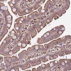 Anti-GAS2L3 Antibody