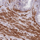 Immunohistochemical staining of human prostate shows strong cytoplasmic positivity in smooth muscle cells.