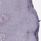 Immunohistochemical staining of human skin shows no cytoplasmic positivity in squamous epithelial cells as expected.