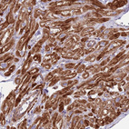 Immunohistochemical staining of human heart muscle shows strong cytoplasmic positivity in cardiomyocytes.