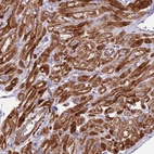 Immunohistochemical staining of human heart muscle shows strong cytoplasmic positivity in cardiomyocytes.