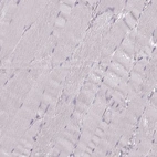 Immunohistochemical staining of human skeletal muscle shows no positivity in myocytes as expected.