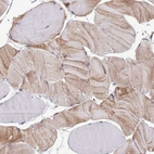 Immunohistochemical staining of human skeletal muscle shows moderate cytoplasmic positivity in myocytes.