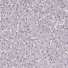 Anti-KRT74 Antibody