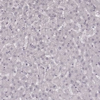 Immunohistochemical staining of human liver shows no positivity in hepatocytes as expected.