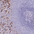 Anti-PHLPP2 Antibody
