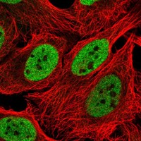 Anti-INO80 Antibody