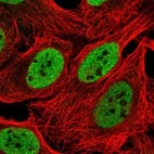 Anti-INO80 Antibody