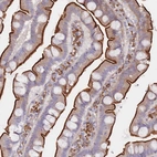 Immunohistochemical staining of human gastrointestinal shows strong membranous positivity in glandular cells.
