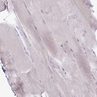 Immunohistochemical staining of human skeletal muscle shows no positivity in myocytes as expected.