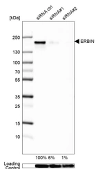 Western blot analysis in U2OS cells transfected with control siRNA, target specific siRNA probe #1 and #2, using Anti-ERBIN antibody. Remaining relative intensity is presented. Loading control: Anti-GAPDH.
