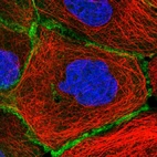 Immunofluorescent staining of human cell line A-431 shows localization to plasma membrane.