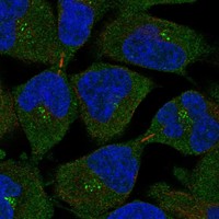Anti-MS4A12 Antibody