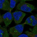 Anti-MS4A12 Antibody