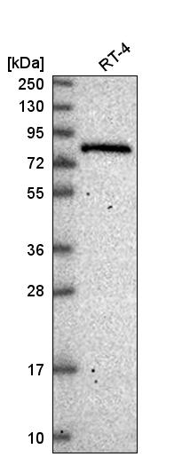 Anti-ESRP2 Antibody